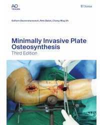 Minimally Invasive Plate Osteosynthesis: 3rd Edition